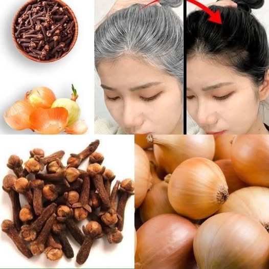 Discover The Surprising Benefits Of Cloves And Onions For Hair