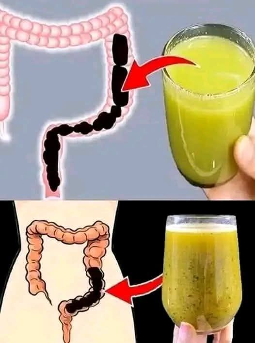 Lose Weight by Cleansing Your Colon in 7 Days