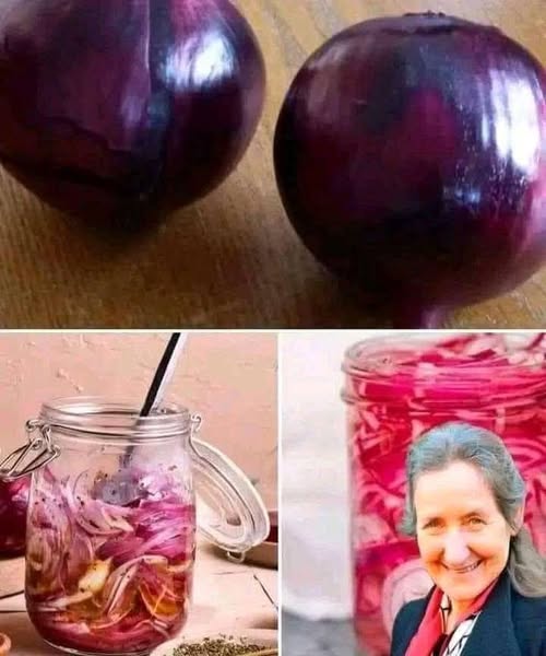 How to Use Red Onion for Varicose Veins: You'll be amazed, I promise -Why Red Onion?