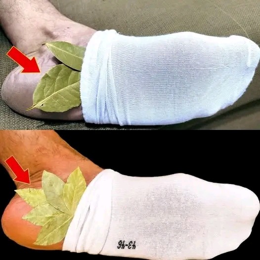 Put a Bay Leaf on Your Feet? Here’s Why You Should Try It!