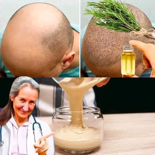 Rosemary Hair Butter for Extreme Hair Growth: The Ultimate DIY Recipe