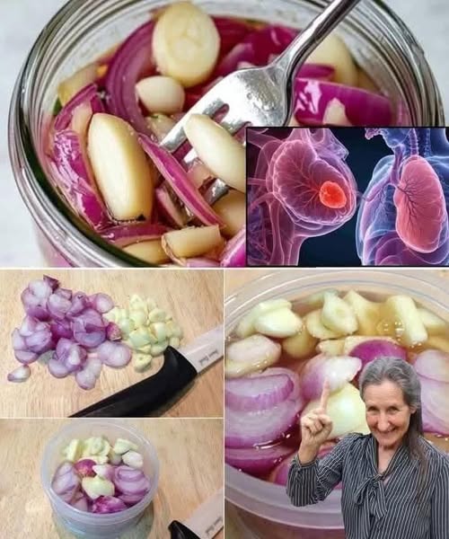 A Natural Remedy for Coughs, Colds, and Lung Health: Red Onion, Garlic, and Honey