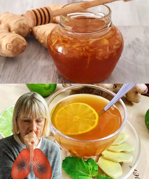 Honey Lemon Ginger Remedy: A Natural Solution for Cough Relief