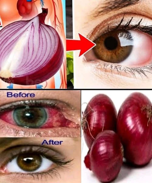 How to Use Onion to Improve Your Vision Naturally in Just 5 Days